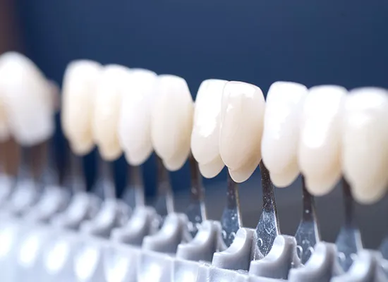 Our dental laboratory | High-quality dentures