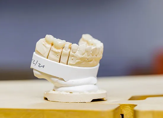 Our dental laboratory | High-quality dentures